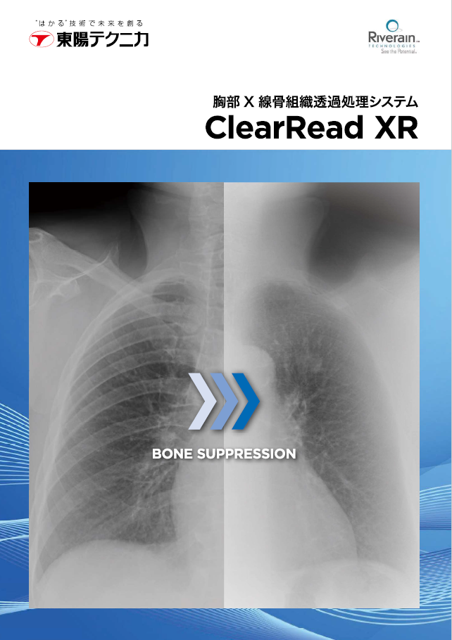 胸部X線骨組織透過処理システム『ClearRead BS』 | 東陽テクニカ 